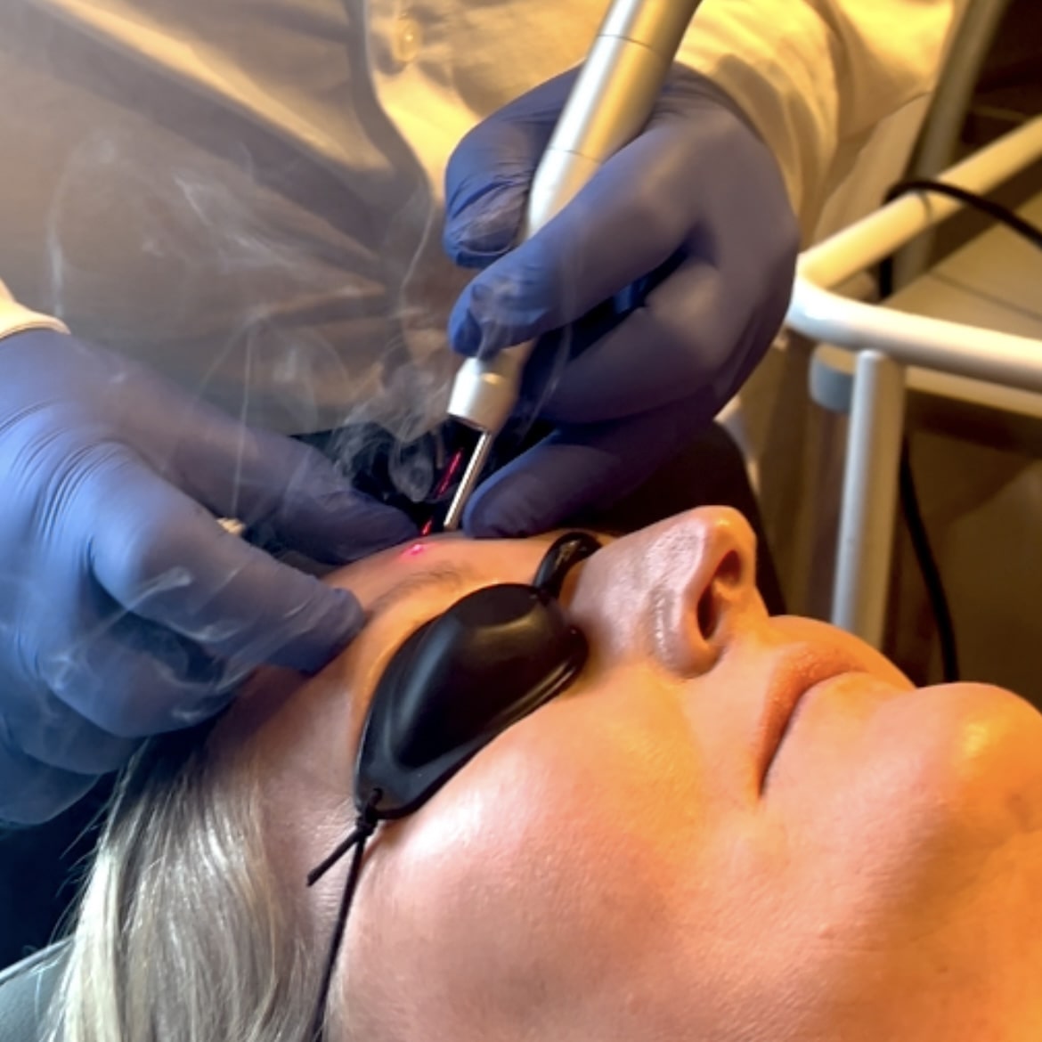 Konsultation med hudlæge inden behandling hos Fyrsterling Clinic