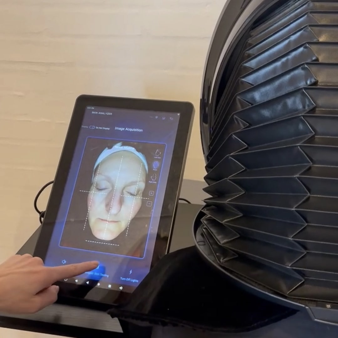 Hudanalyse i kosmetisk klinik i Odense på Fyn