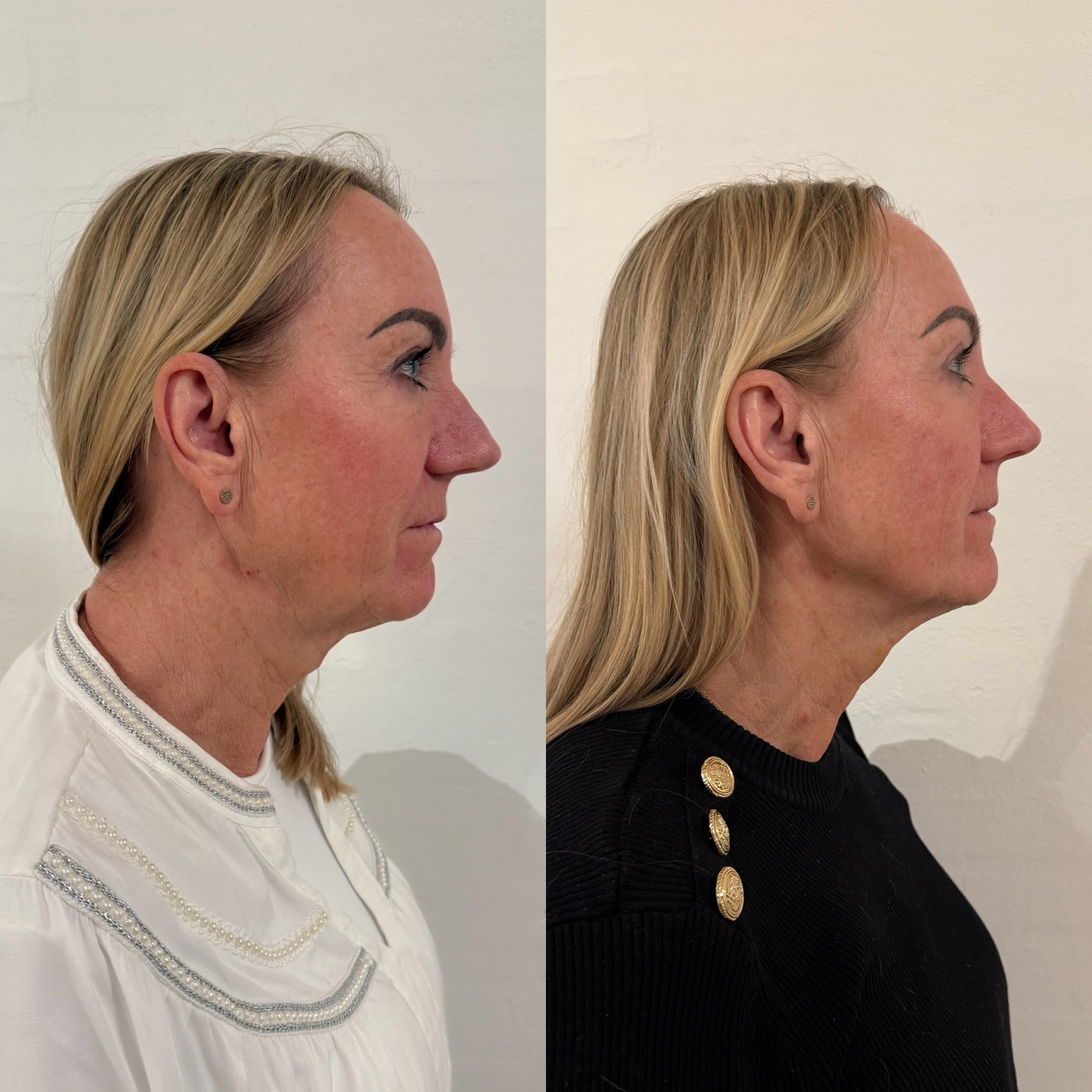 Kunde med hamsterposer hos Fyrsterling Clinic i Odense på Fyn 