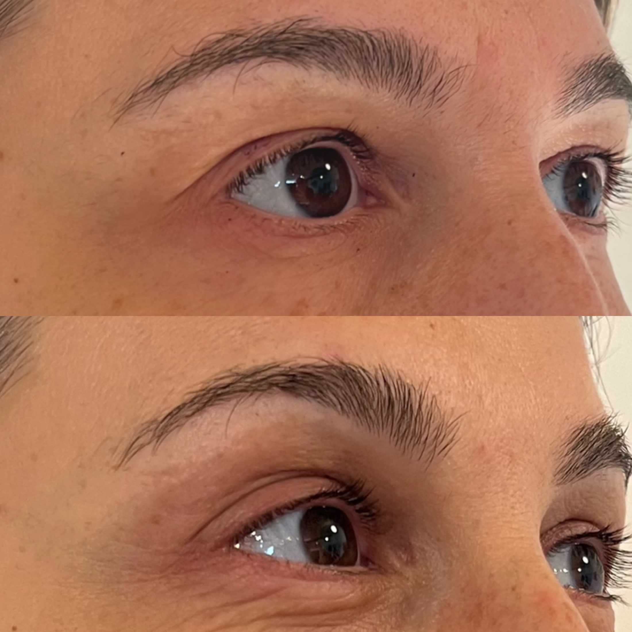 Botox behandling priser i Odense på Fyn