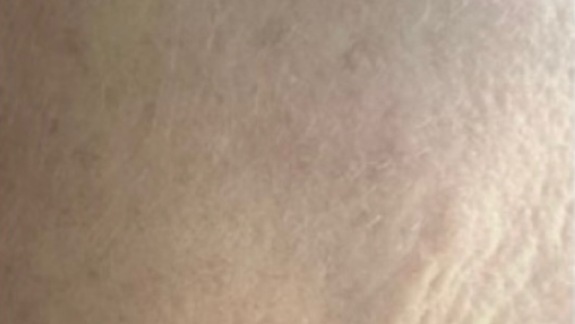 ZO Skin Health Antiaging hudpleje fra Fyrsterling Clinic