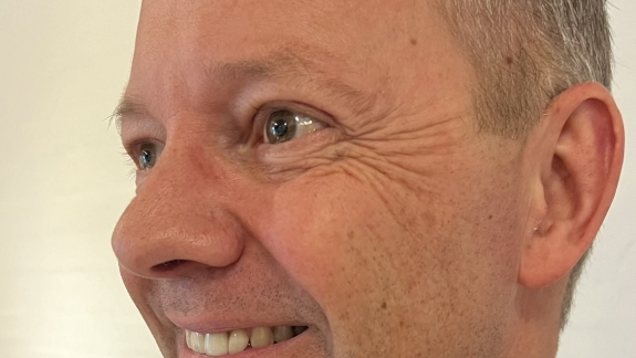 Billede af mand før botox i kragetæer - behandlet ved klinik i Odense