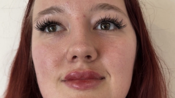 Kunde fra Fyrsterling Clinic i Odense på Fyn tæt på Kolding