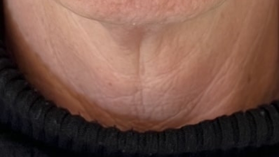 Kurforløb med 3 behandlinger Ejal40